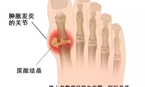 【菠萝皮的制作方法】菠萝带皮的吃法有哪些 - 菠萝带皮的吃法网
